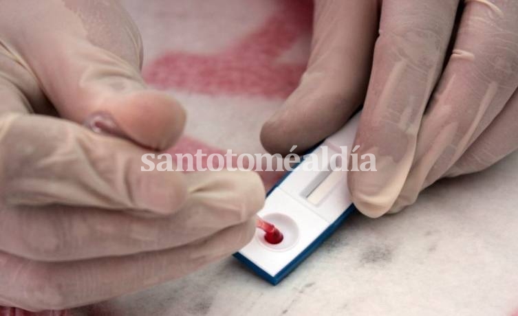 El 98% de las infecciones con VIH son por relaciones sexuales sin protección 