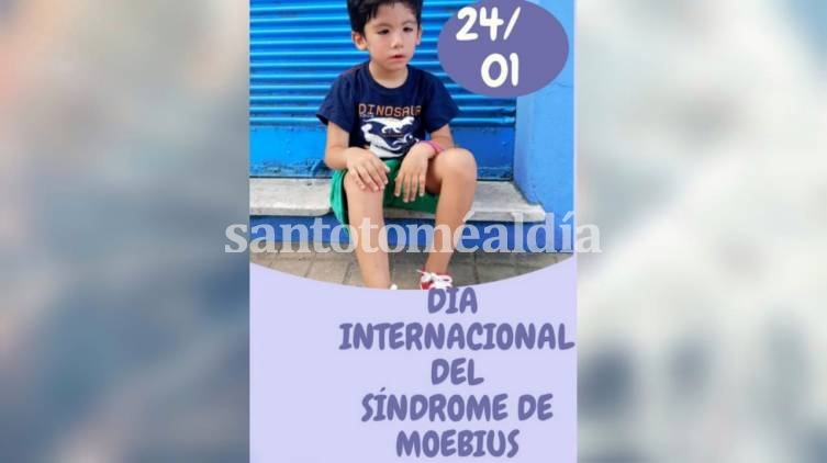 Jornada de concientización por el Día Mundial del Síndrome de Moebius