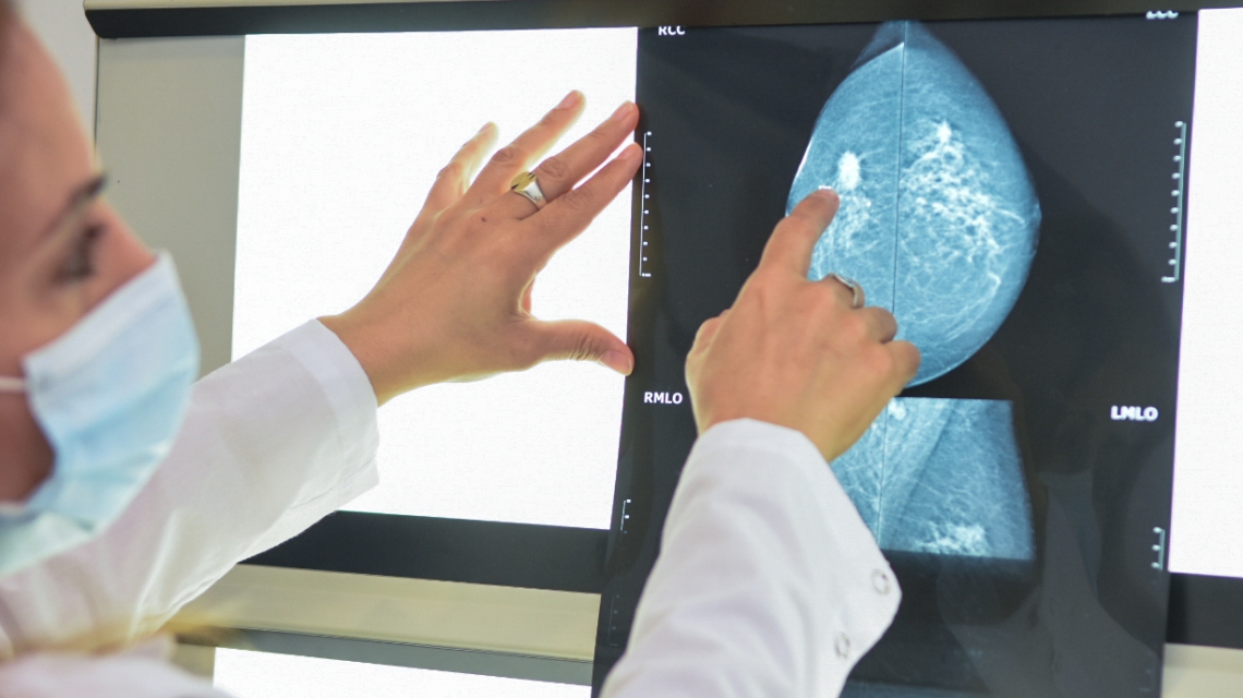 Día Mundial de la Lucha contra el Cáncer de Mama: en Santa Fe se diagnostican más de 1.600 casos al año