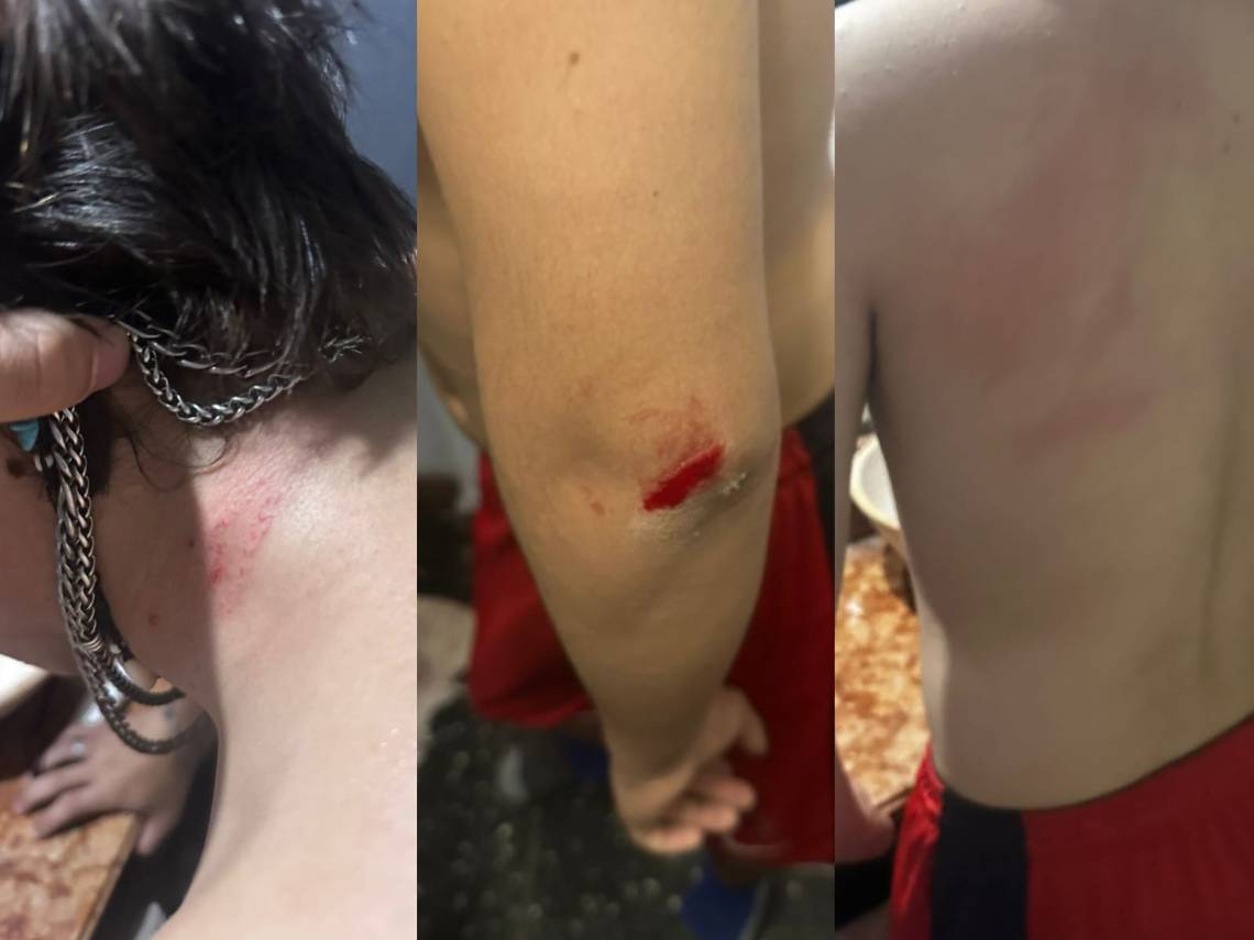 Grave episodio de violencia: vecino atacó a un chico de 15 años con una pala